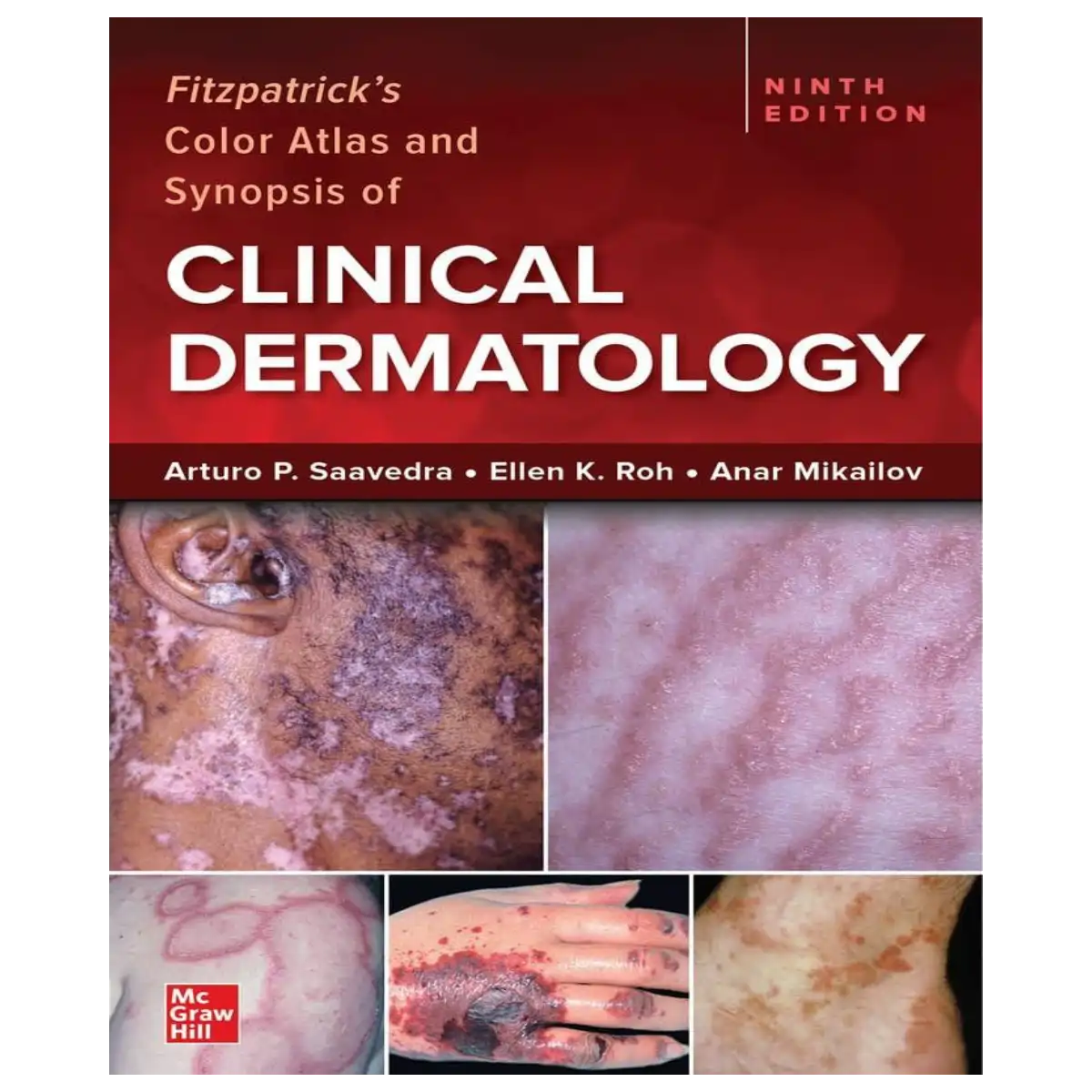 Fitzpatrick's Color Atlas and Synopsis of Clinical Dermatology, Ninth Edition - Paperback - ISBN: 9781264278015