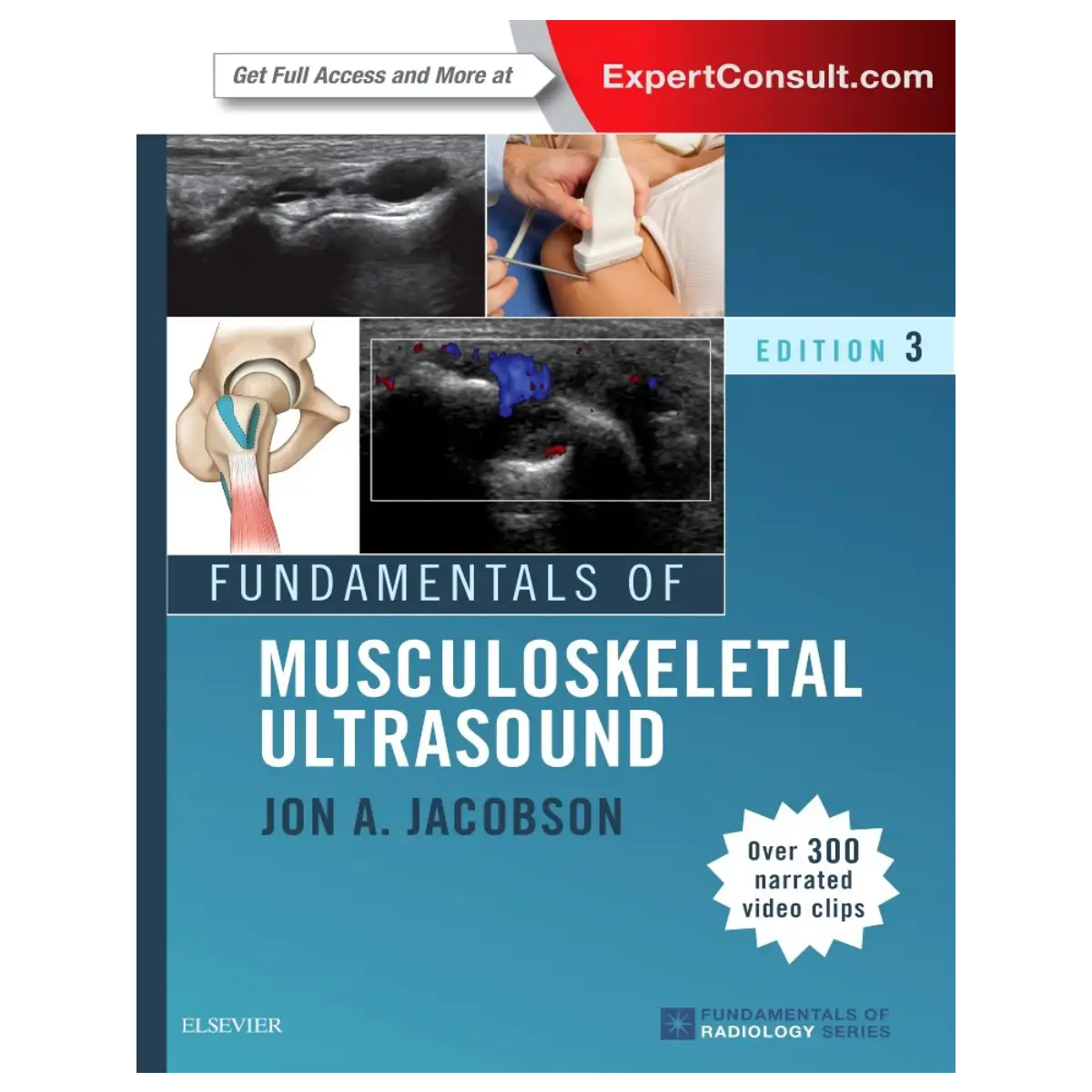 Fundamentals of Musculoskeletal Ultrasound (Fundamentals of Radiology) 3rd Edition - Paperback - ISBN: 9780323445252